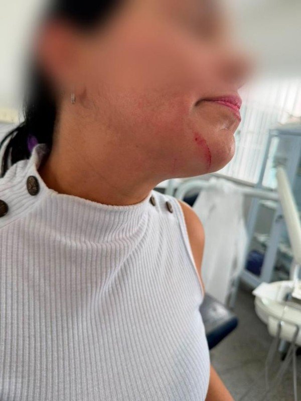 Servidora é agredida por paciente em unidade de saúde