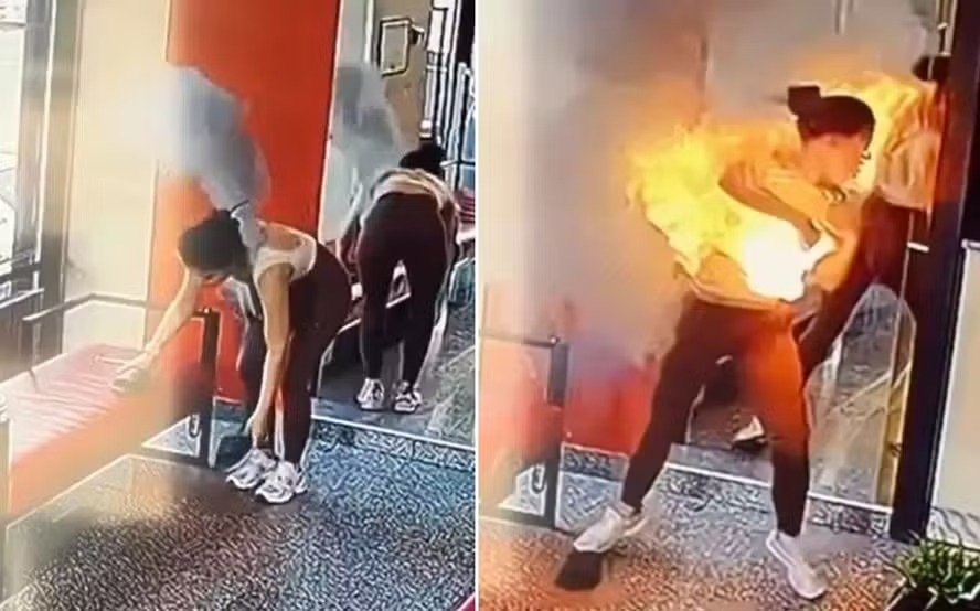 Power Bank explode em bolsa e deixa influenciadora gravemente queimada após saída da academia (Vídeo)