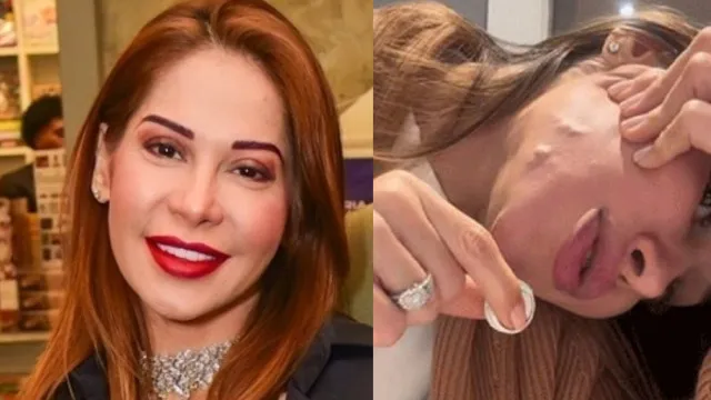 Famosas admitem seus maiores arrependimentos de beleza: “Não façam”