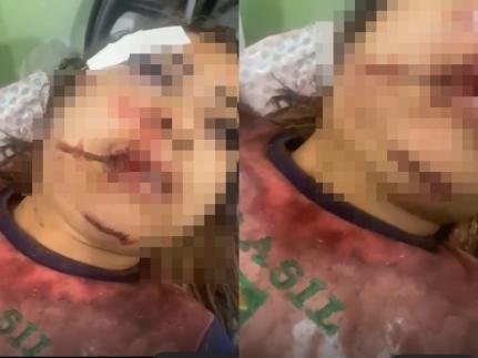 Garota de programa é brutalmente agredida e quase morta em MT