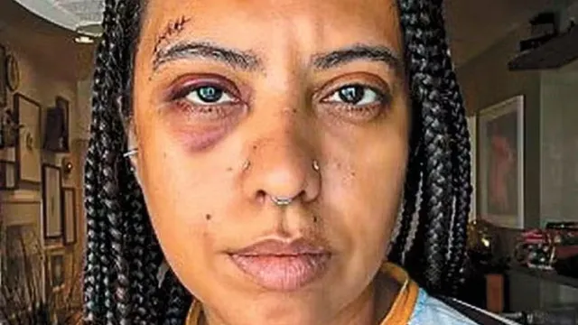 Influenciadora leva seis pontos após agressão em roda de samba no Rio
