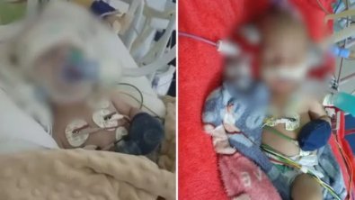 Bebê que levou soco continua na UTI um mês