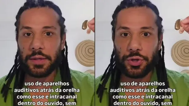 Ator da Globo revela perda de audição: ‘Vou ser completamente surdo’